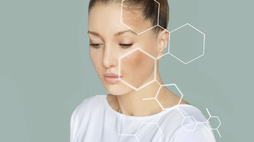 ポテンツァとは？毛穴治療における仕組み