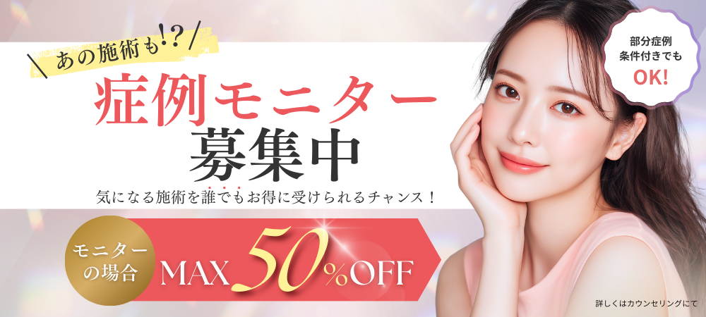 モニターバナー